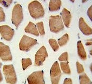 PHYH Antibody