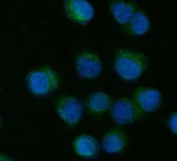 CYP7A1 Antibody
