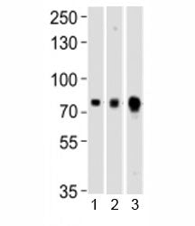 Western blot testing of Melk antibody at 1:1000 dilution and mouse 1) ovary, 2) spleen and 3) testis