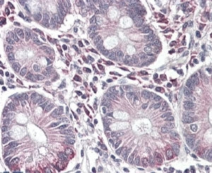 SLC10A2 Antibody