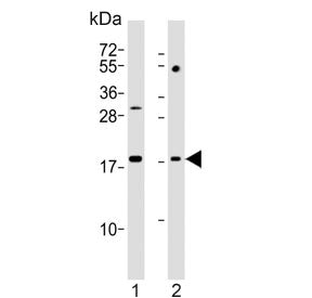 KiSS-1 Antibody