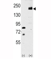 LRP6 Antibody