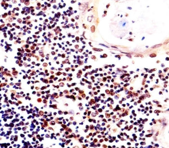 IHC testing of FFPE human thymus tissue with Histone H2AX antibody. HIER: steam section in pH6 citra