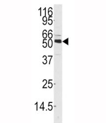 CAMKK1 Antibody