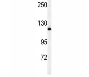 NEDD4 Antibody