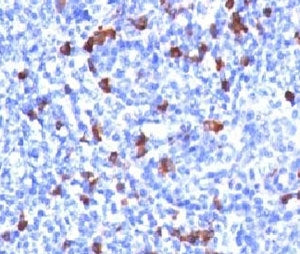IgG Heavy Chain Antibody