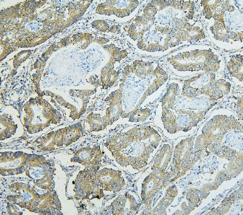 RPL13A Antibody