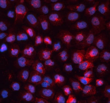 Transferrin Receptor Antibody