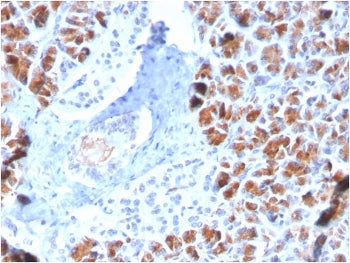 BARX1 Antibody