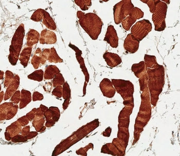 SLC16A3 Antibody / MCT4