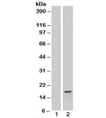 FABP2 Antibody