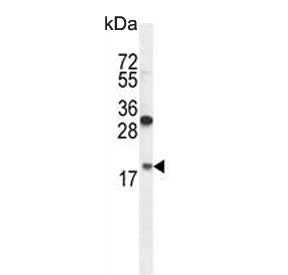 RPL27A Antibody