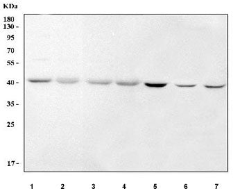 Western blot testing of 1) human ThP-1, 2) human K562, 3) human PC-3, 4) human HepG2, 5) rat testis