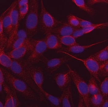NDP52 Antibody / Nuclear dot protein 52 / CALCOCO2