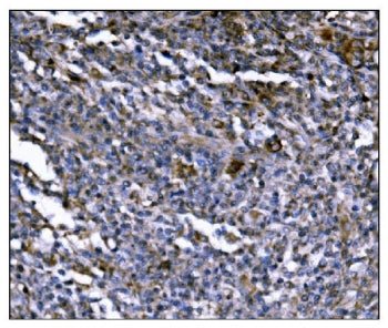 ERAP2 Antibody