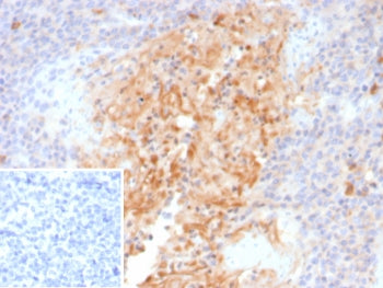 IHC staining of FFPE human tonsil tissue with Alpha-1-Antitrypsin antibody (clone AAT/4571). Inset: