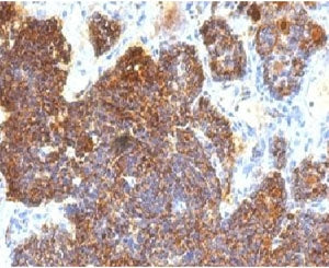 IHC testing of FFPE human parathyroid with Parathyroid Hormone antibody (clone PRTM1-3). FFPE testin