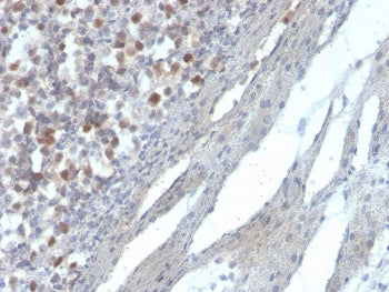 IHC staining of FFPE human kidney with RAD51 antibody. HIER: boil tissue sections in pH 9 10mM Tris
