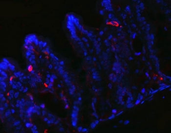 PYY Antibody / Peptide YY
