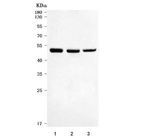 Death receptor 5 Antibody / Dr5