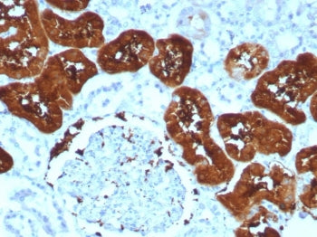 FABP1 Antibody