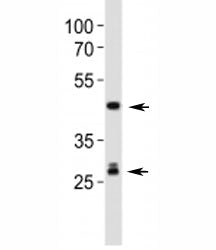 Western blot analysis of lysate from mouse liver tissue lysate using Shh antibody. Predicted molecul