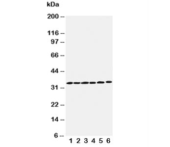 Western blot testing of Cyclin D1 antibody and Lane 1: rat testis; 2: rat ovary; 3: rat brain; 4: He