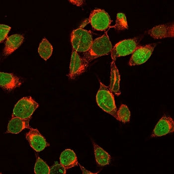 Ki67 Antibody