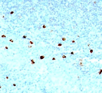 IgM Heavy Chain Antibody
