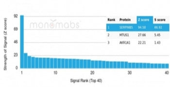 Analysis of a HuProt(TM) microarray containing more than 19,000 full-length human proteins using MAS