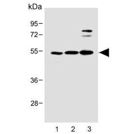 STRADA Antibody / LYK5