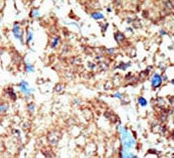 Eph Receptor B1 Antibody / EphB1