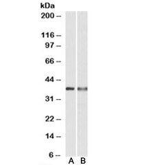 CAPG Antibody