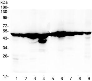 FH Antibody / Fumarate hydratase