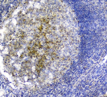IHC staining of FFPE human tonsil tissue with PLK2 antibody. HIER: boil tissue sections in pH8 EDTA