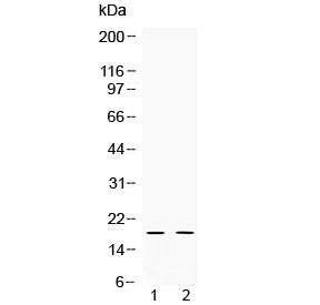 Western blot testing of 1) rat testis and 2) human HeLa lysate with Alpha Defensin 1 antibody at 0.5
