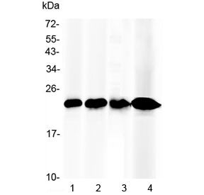 RBP4 Antibody / Retinol Binding Protein 4