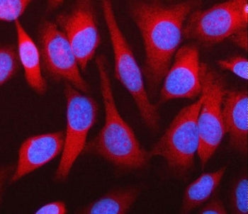 Immunofluorescent staining of FFPE human HeLa cells with MPHOSPH9 antibody (red) and DAPI nuclear st