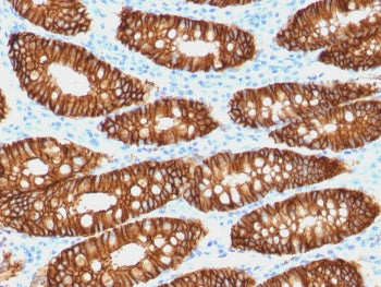 EpCAM Antibody / CD326