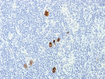 EBV Antibody / Epstein-Barr Virus