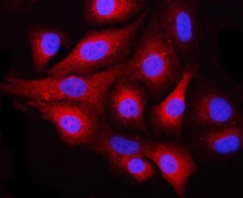 Immunofluorescent staining of FFPE human A549 cells with NEK6 antibody (red) and DAPI nuclear stain
