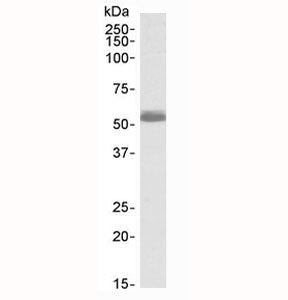 ADRB1 Antibody