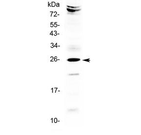 SRY Antibody / Sex-Determining Region Y (Middle Region)