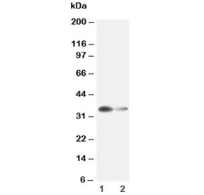 Arginase 1 Antibody