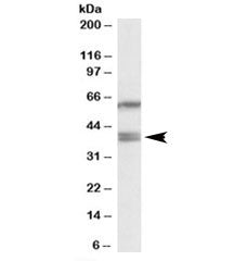 PON2 Antibody