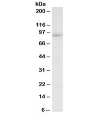 Western blot testing of MOLT4 lysate with FYB antibody at 0.2ug/ml. Predicted molecular weight: ~90k