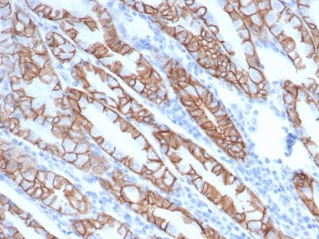 IHC staining of FFPE human stomach tissue glandular cells with recombinant CTNND1 antibody (clone rC