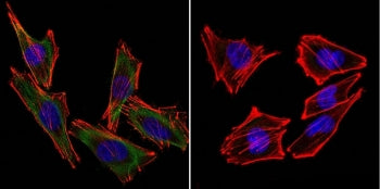 S100B Antibody