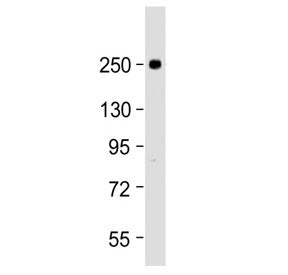 SCN1A Antibody / Nav1.1 (Center Region)