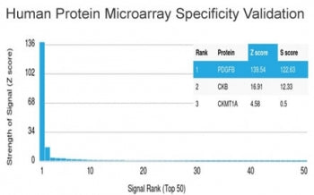 Analysis of HuProt(TM) microarray containing more than 19,000 full-length human proteins using PDGF